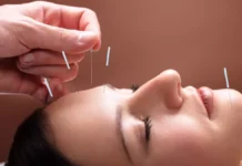Acupuntura: Uma Terapia Milenar para a Saúde e o Bem-Estar